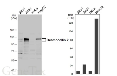 Anti-Desmocollin 2 antibody [HL3572] used in Western Blot (WB). GTX641543