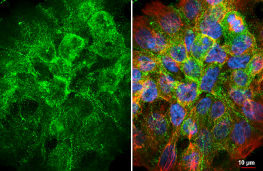 Anti-Desmocollin 2 antibody [HL3572] used in Immunocytochemistry/ Immunofluorescence (ICC/IF). GTX641543