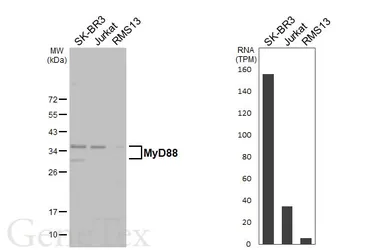 Anti-MyD88 antibody [HL3601] used in Western Blot (WB). GTX641576