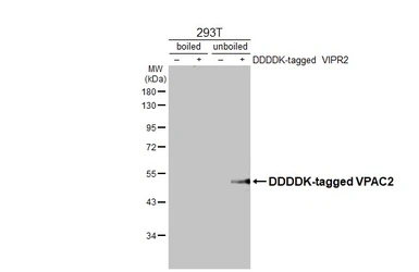 Anti-VPAC2 antibody [HL3625] used in Western Blot (WB). GTX641600