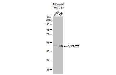 Anti-VPAC2 antibody [HL3625] used in Western Blot (WB). GTX641600