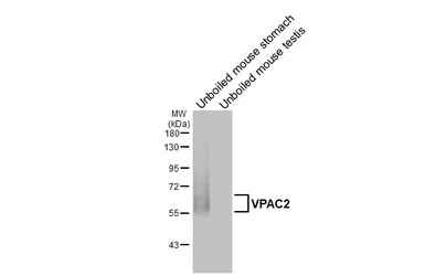 Anti-VPAC2 antibody [HL3625] used in Western Blot (WB). GTX641600