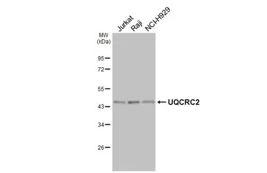 Anti-UQCRC2 antibody [HL3638] used in Western Blot (WB). GTX641629