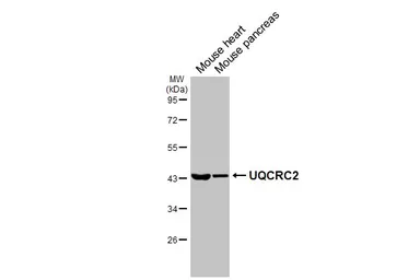 Anti-UQCRC2 antibody [HL3638] used in Western Blot (WB). GTX641629