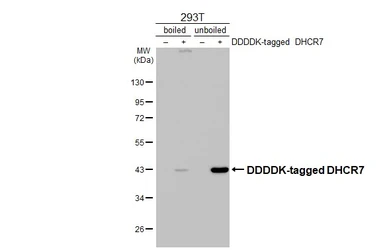 Anti-DHCR7 antibody [HL3685] used in Western Blot (WB). GTX641713