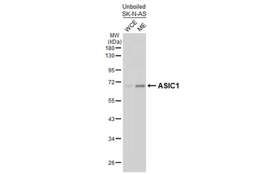 Anti-ASIC1 antibody [GT73] used in Western Blot (WB). GTX641718