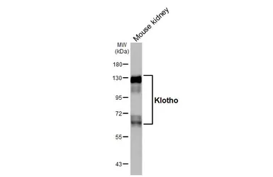 Anti-Klotho antibody [HL3706] used in Western Blot (WB). GTX641878