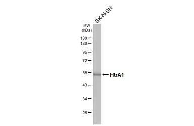 Anti-HtrA1 antibody [HL3709] used in Western Blot (WB). GTX641881