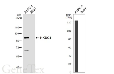 Anti-HKDC1 antibody [HL3743] used in Western Blot (WB). GTX641933