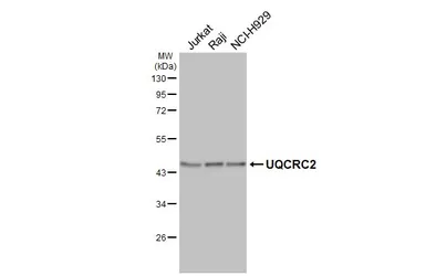 Anti-UQCRC2 antibody [HL3749] used in Western Blot (WB). GTX641948