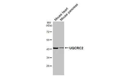 Anti-UQCRC2 antibody [HL3749] used in Western Blot (WB). GTX641948