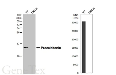 Anti-Procalcitonin antibody [HL3769] used in Western Blot (WB). GTX641968