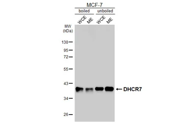 Anti-DHCR7 antibody [HL3854] used in Western Blot (WB). GTX642088