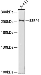 Anti-53BP1 antibody used in Western Blot (WB). GTX64370