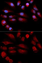 Anti-53BP1 antibody used in Immunocytochemistry/ Immunofluorescence (ICC/IF). GTX64370