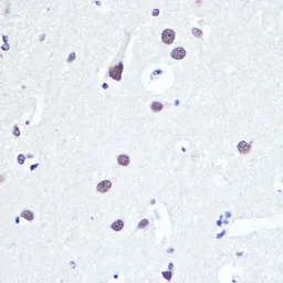 Anti-53BP1 antibody used in IHC (Paraffin sections) (IHC-P). GTX64370