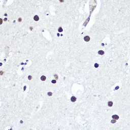 Anti-53BP1 antibody used in IHC (Paraffin sections) (IHC-P). GTX64370