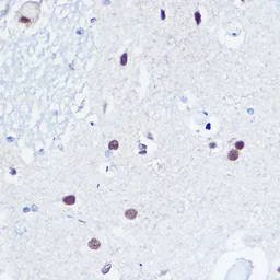 Anti-53BP1 antibody used in IHC (Paraffin sections) (IHC-P). GTX64370