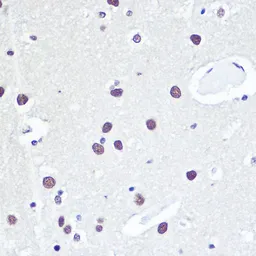 Anti-53BP1 antibody used in IHC (Paraffin sections) (IHC-P). GTX64370