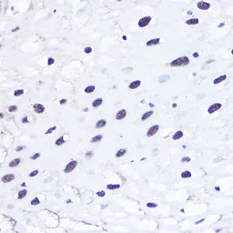 Anti-53BP1 antibody used in IHC (Paraffin sections) (IHC-P). GTX64370