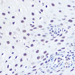 Anti-53BP1 antibody used in IHC (Paraffin sections) (IHC-P). GTX64370