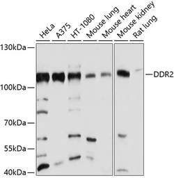 Anti-DDR2 antibody used in Western Blot (WB). GTX64433