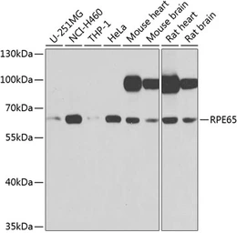 Anti-RPE65 antibody used in Western Blot (WB). GTX64456