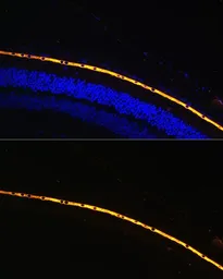 Anti-RPE65 antibody used in IHC (Paraffin sections) (IHC-P). GTX64456