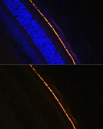 Anti-RPE65 antibody used in IHC (Paraffin sections) (IHC-P). GTX64456