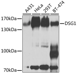 Anti-Desmoglein 1 antibody used in Western Blot (WB). GTX64482