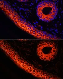 Anti-Desmoglein 1 antibody used in IHC (Paraffin sections) (IHC-P). GTX64482