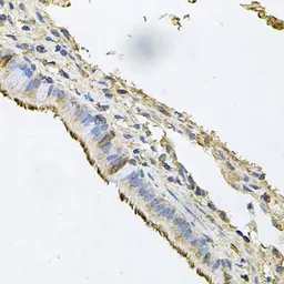 Anti-Desmoglein 1 antibody used in IHC (Paraffin sections) (IHC-P). GTX64482