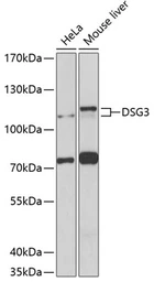 Anti-Desmoglein 3 antibody used in Western Blot (WB). GTX64516