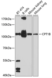 Anti-CPT1B antibody used in Western Blot (WB). GTX64535