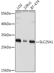 Anti-SLC25A1 antibody used in Western Blot (WB). GTX64580