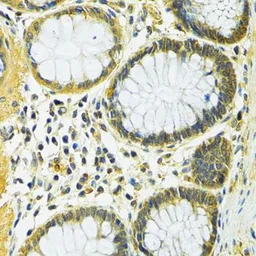 Anti-SLC25A1 antibody used in IHC (Paraffin sections) (IHC-P). GTX64580