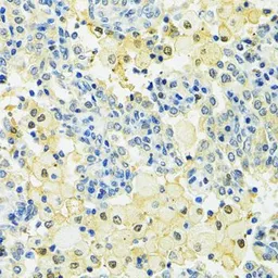 Anti-SLC25A1 antibody used in IHC (Paraffin sections) (IHC-P). GTX64580