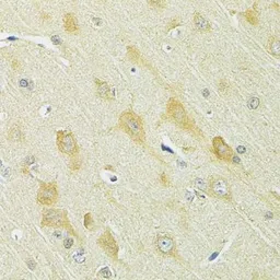 Anti-SLC25A1 antibody used in IHC (Paraffin sections) (IHC-P). GTX64580