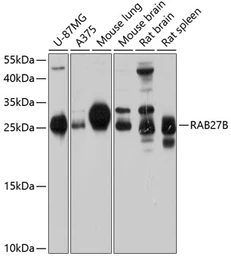 Anti-RAB27B antibody used in Western Blot (WB). GTX64615