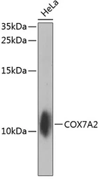 Anti-COX7A2 antibody used in Western Blot (WB). GTX64639