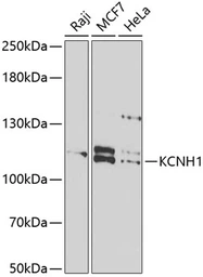 Anti-KCNH1 antibody used in Western Blot (WB). GTX64743