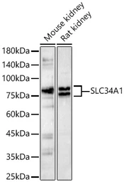 Anti-SLC34A1 antibody used in Western Blot (WB). GTX64769