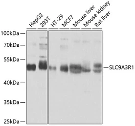 Anti-NHERF1 antibody used in Western Blot (WB). GTX64798