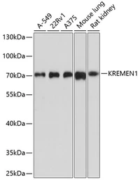 Anti-KREMEN1 antibody used in Western Blot (WB). GTX64893