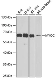 Anti-Myocilin antibody used in Western Blot (WB). GTX64982