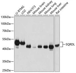 Anti-SQRDL antibody used in Western Blot (WB). GTX65548