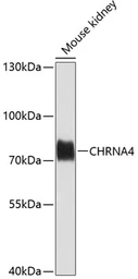 Anti-AChR alpha 4 antibody used in Western Blot (WB). GTX65576