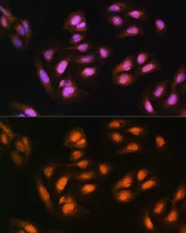 Anti-ADRM1 antibody used in Immunocytochemistry/ Immunofluorescence (ICC/IF). GTX65581