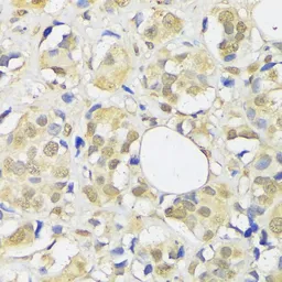 Anti-ADRM1 antibody used in IHC (Paraffin sections) (IHC-P). GTX65581