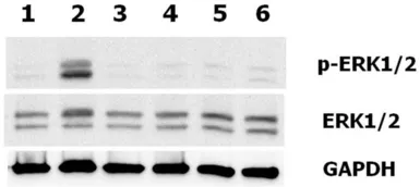 Human Progranulins protein (active). GTX65641-pro